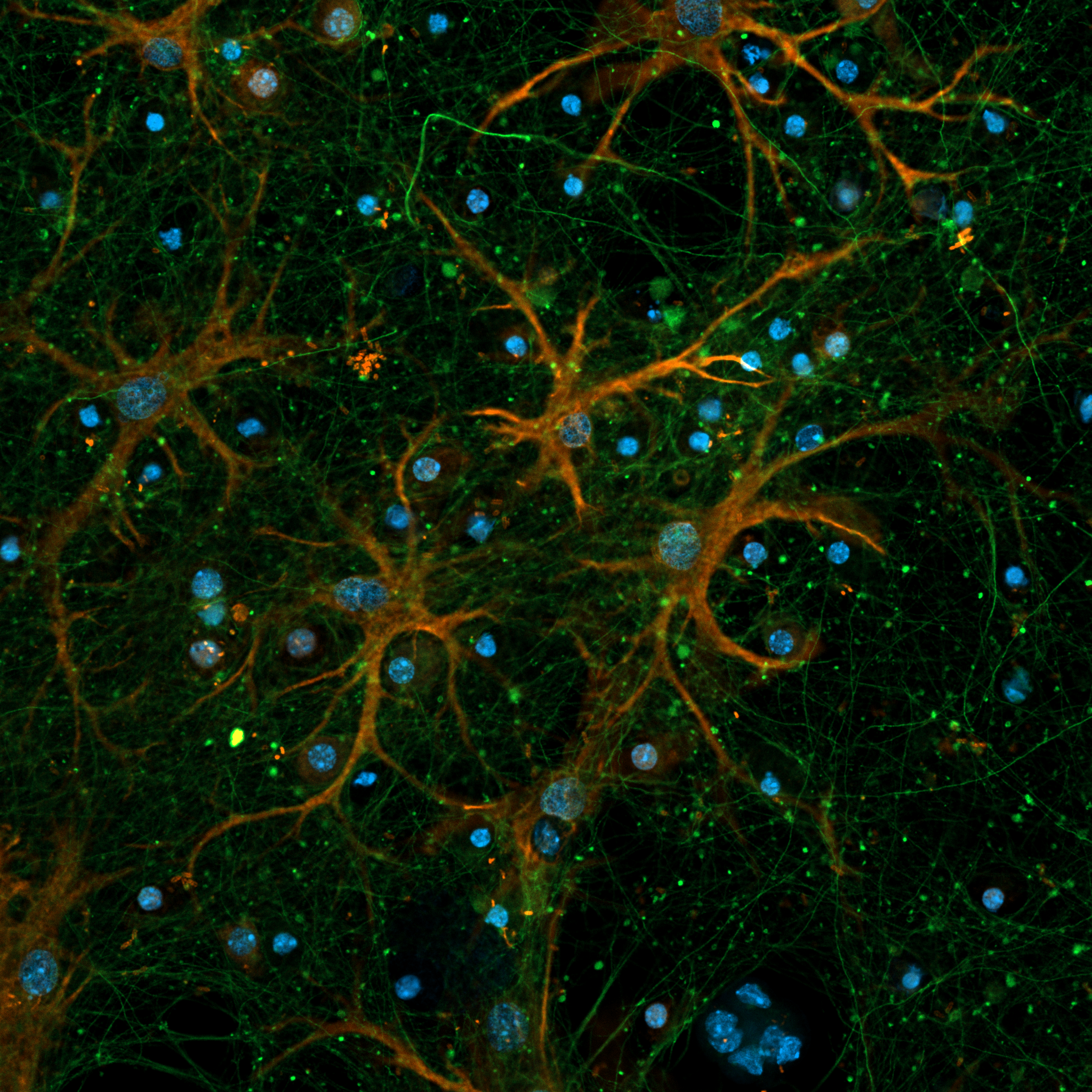 Нейроны, астроциты и ядра
